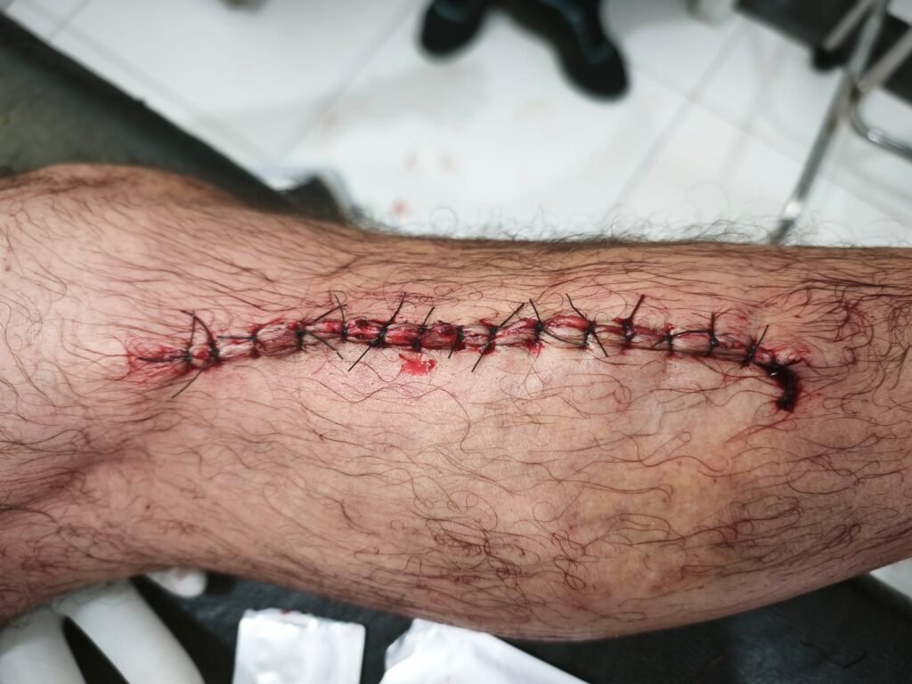 WhatsApp Image 2026-06-03 at 13.03.18 thumbnail
